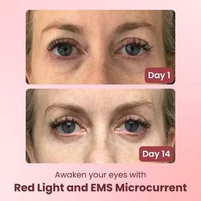 ROH™ EyeRevive Pro| Red Light Therapy & EMS Eye Massager
