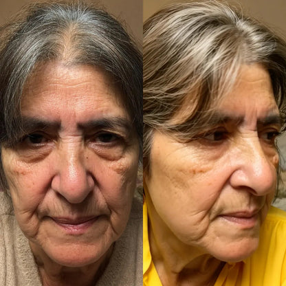 ROH™ EyeRevive Pro| Red Light Therapy & EMS Eye Massager