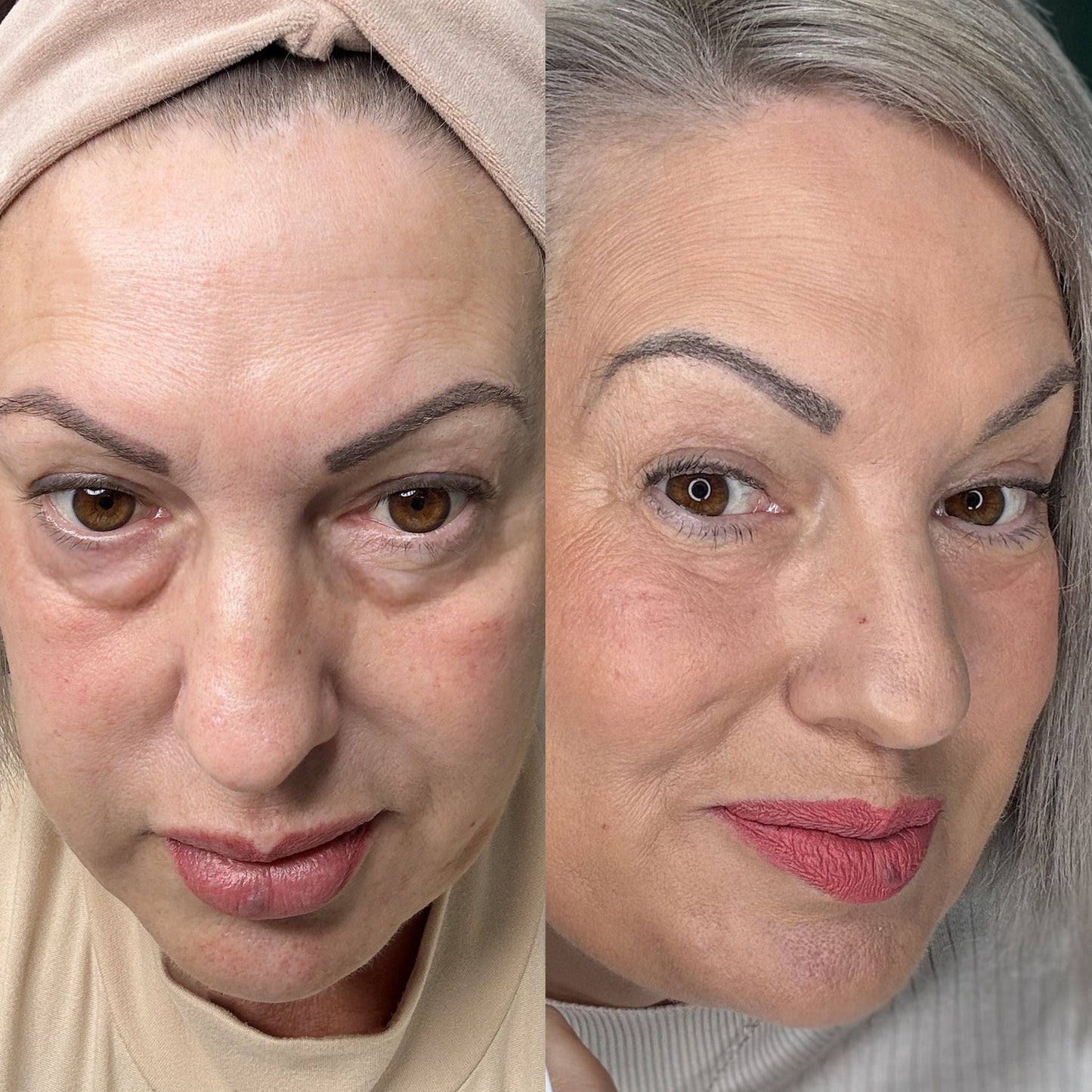 ROH™ EyeRevive Pro| Red Light Therapy & EMS Eye Massager